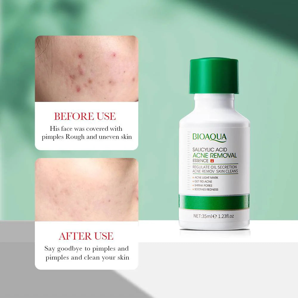 Bioaqua Salicylic Acid Acne Removal Serum